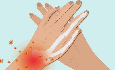 hình ảnh đau khớp cổ tay