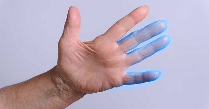 Tê đầu ngón tay có nguy hiểm không