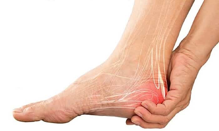 triệu chứng đau gót chân
