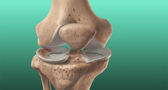 cách chẩn đoán chấn thương rách sụn chêm khớp gối