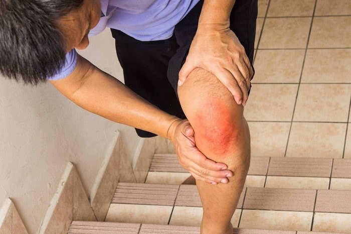 Rách sụn chêm khớp gối có nguy hiểm không