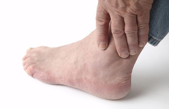 tìm hiểu chung về bệnh viêm khớp cổ chân