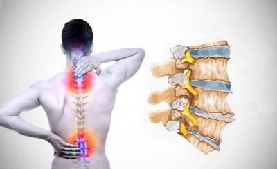 tìm hiểu chung về bệnh thoái hóa cột sống