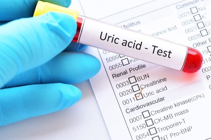 hiểu đúng về khái niệm chỉ số axit uric