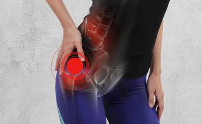 Dấu hiệu của tình trạng đau cơ mông