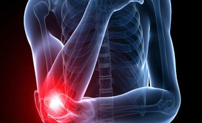 bệnh tìm ẩn khi bị đau khớp khuỷu tay