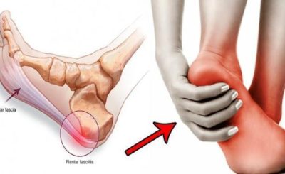 cách chữa đau gót chân tại nhà