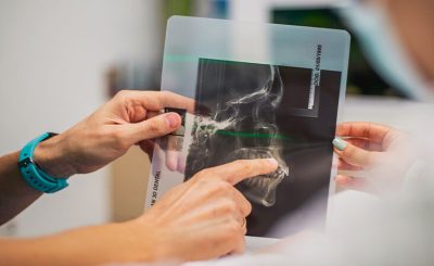 Tùy thuộc vào nguyên nhân cụ thể gây bệnh, bác sĩ sẽ tư vấn bạn cách chữa xương khớp kêu lục cục phù hợp