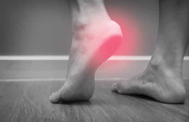 đau gót chân căn bệnh phổ biến ở xã hội hiện đại