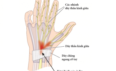 cách chữa tê đầu ngón tay tại nhà